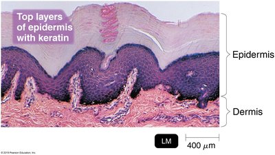 Layers of epidermis with keratin