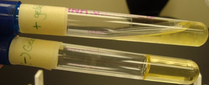 Gelatinase test results: solid and liquefied tubes