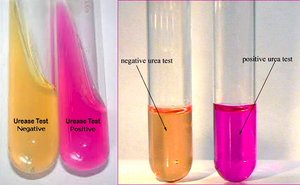 Urease test results: positive (pink) and negative (yellow) tubes