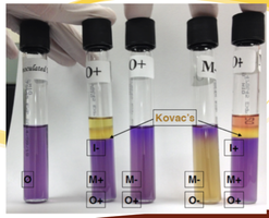 MIO test results: tubes showing motility, indole, and ornithine reactions