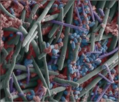 Microscopic view of oral biofilm community