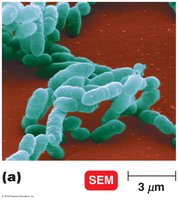Scanning electron micrograph of bacteria