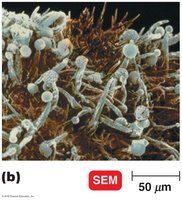 Scanning electron micrograph of fungi