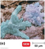 Scanning electron micrograph of protozoa