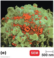 Scanning electron micrograph of viruses