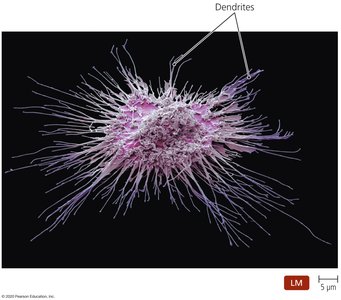 Dendritic cell with dendrites