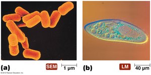 SEM and LM images of prokaryotic and eukaryotic cells
