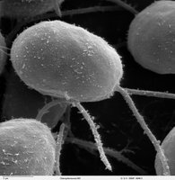 SEM image of bacterial flagella