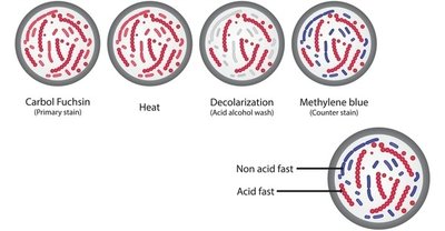 Acid-fast stain results
