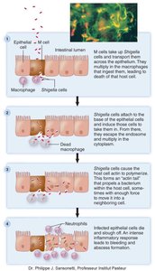 Shigella pathogenesis in the intestine