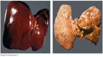 Giardia lamblia trophozoite