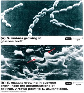 S. mutans growing in glucose and sucrose broth