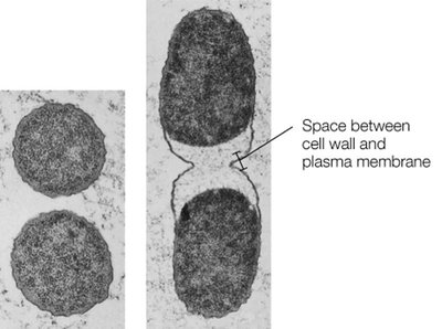 Plasmolysis in high-salt conditions