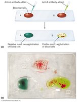 Hemagglutination for blood typing