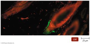 Fluorescent antibody test showing rabies proteins
