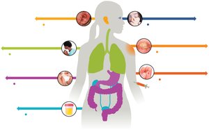 Human body with portals of exit for pathogens