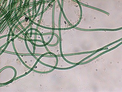 Filamentous cyanobacteria