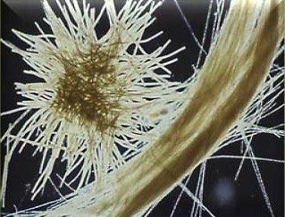 Branching filaments of cyanobacteria