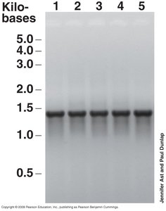 Agarose gel of amplified 16S rRNA genes