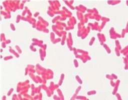 Gram-positive bacteria stained purple