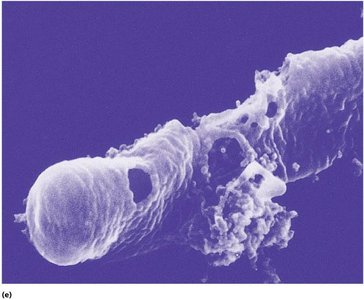 Scanning electron micrograph of bacterial cell treated with penicillin