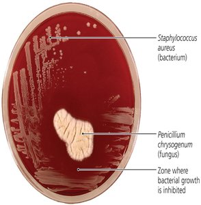 Discovery of Penicillin: Zone of inhibition between Penicillium and Staphylococcus