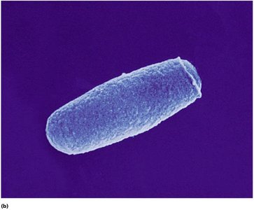 Scanning electron micrograph of bacterial cell with normal cell wall