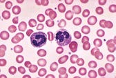 Microscopic view of red blood cells