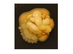Various bacterial colony shapes