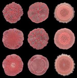 Bacterial colony with rhizoid form