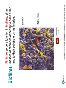 Bacterial Cell Walls
