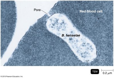 TEM of Bartonella henselae near a red blood cell