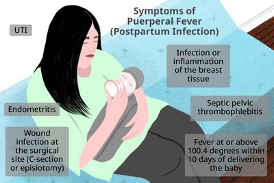 Symptoms of puerperal fever (postpartum infection)