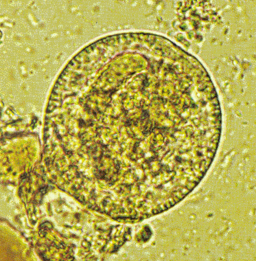 Balantidium coli cyst