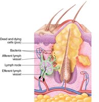 Lymph node filtration process