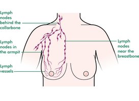 Breast lymph node drainage diagram