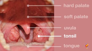 Tonsil location in mouth