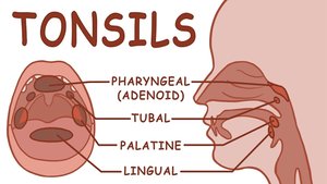 Types of tonsils diagram