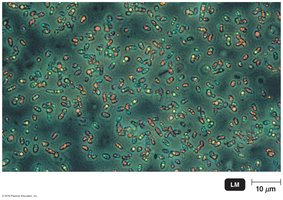 Purple sulfur bacteria