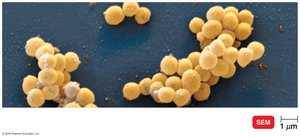 SEM of Staphylococcus aureus