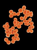 Staphylococcus aureus clusters