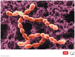 SEM of Streptococcus