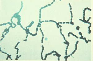 Streptococcus pyogenes