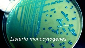 Listeria monocytogenes colonies