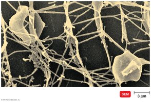 SEM image of Archaea