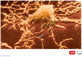 Mycoplasma under microscope