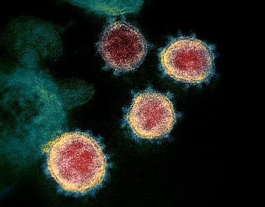 TEM of SARS-CoV-2 virions
