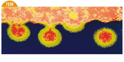 HIV budding from a cell