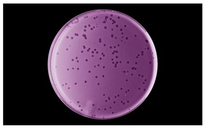 Viral plaque formation