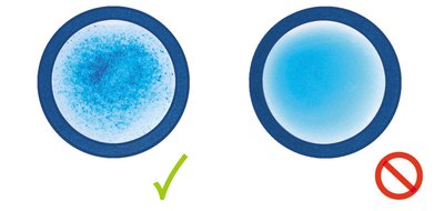 Agglutination test results